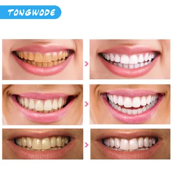 Nové Zuby Bieliace Prúžky 7/14 Kusov Zubné Čistenie aktívne Uhlie Bieliace Prúžky Dyhy za Zub